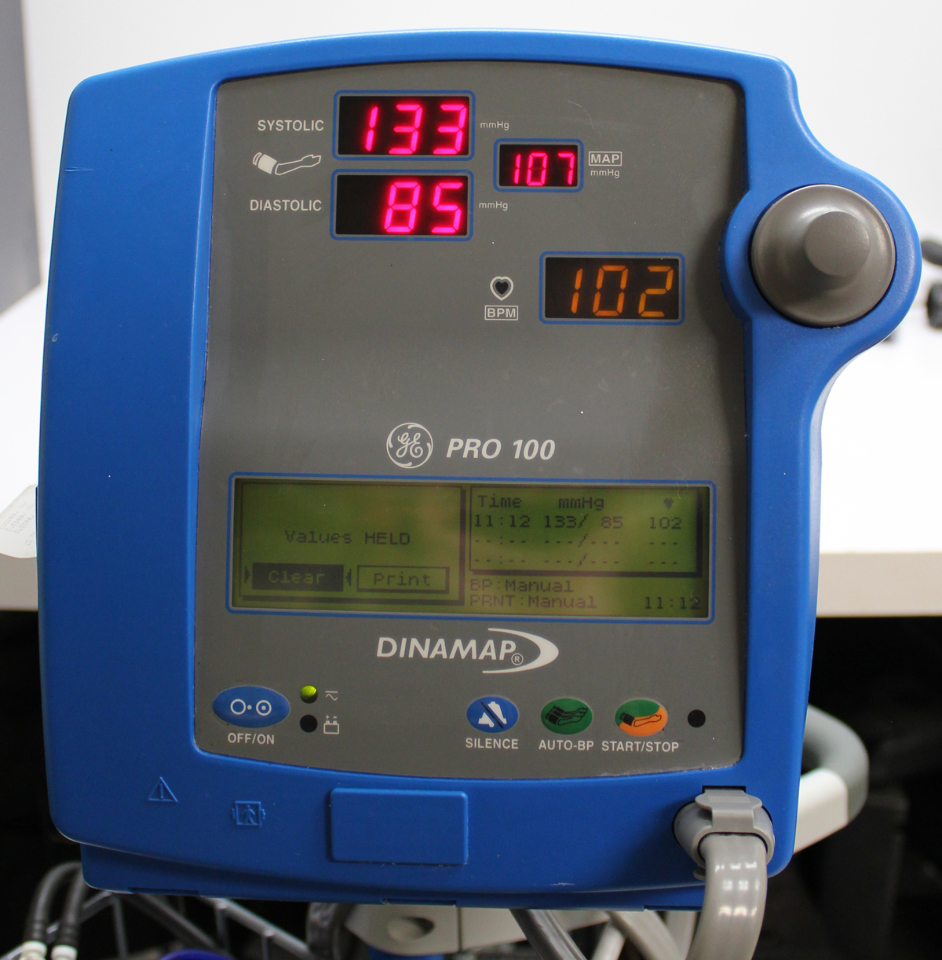 ge critikon dinamap pro 100 vital signs monitor and rolling cart rh socotek co dinamap pro 1000 service manual dinamap pro 100 service manual